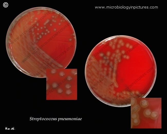 streptococcus pneumoniae, virulent pneumococci